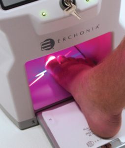 Laser Therapy For Toenail Fungus