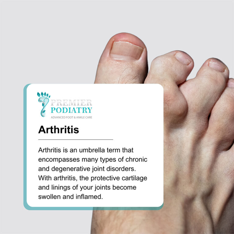 Arthritis Specialist Clifton, NJ Premier Podiatry Velimir Petkov